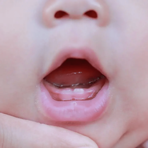 Should I Be Worried About My Baby’s Late Teething?