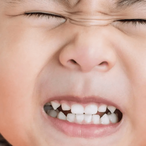 Why Is My Child Grinding Her Teeth? | Bruxism